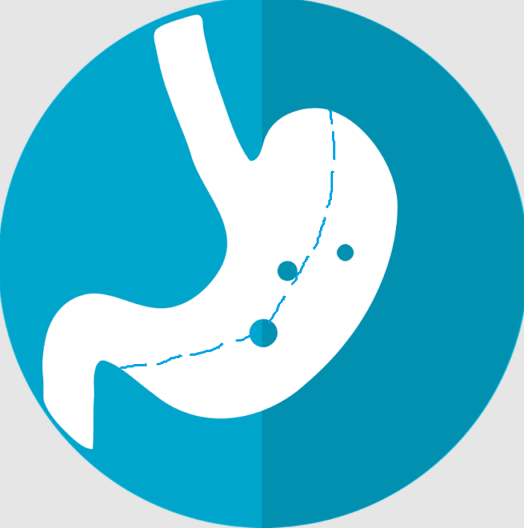 Pre and Post Bariatric Surgery Nutrition Guidelines