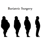 Different Types of Weight Loss Surgery: Pros and Cons 32 bariatric surgery types advantages and disadvantages Different types of weight loss surgery