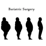 Different Types of Weight Loss Surgery: Pros and Cons 35 bariatric surgery types advantages and disadvantages Different types of weight loss surgery