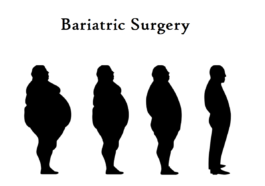 bariatric surgery types advantages and disadvantages Different types of weight loss surgery