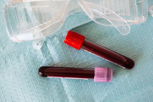 Casgevy for Sickle Cell Disease: The World's First Gene Therapy Approved in UK 14 eliquis obesity apixaban the bmi limit casgevy for sickle cell disease