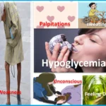 Signs and Symptoms of Hypoglycemia in Newborns, Pregnant, and Old Age 25 signs and symptoms of hypoglycemia