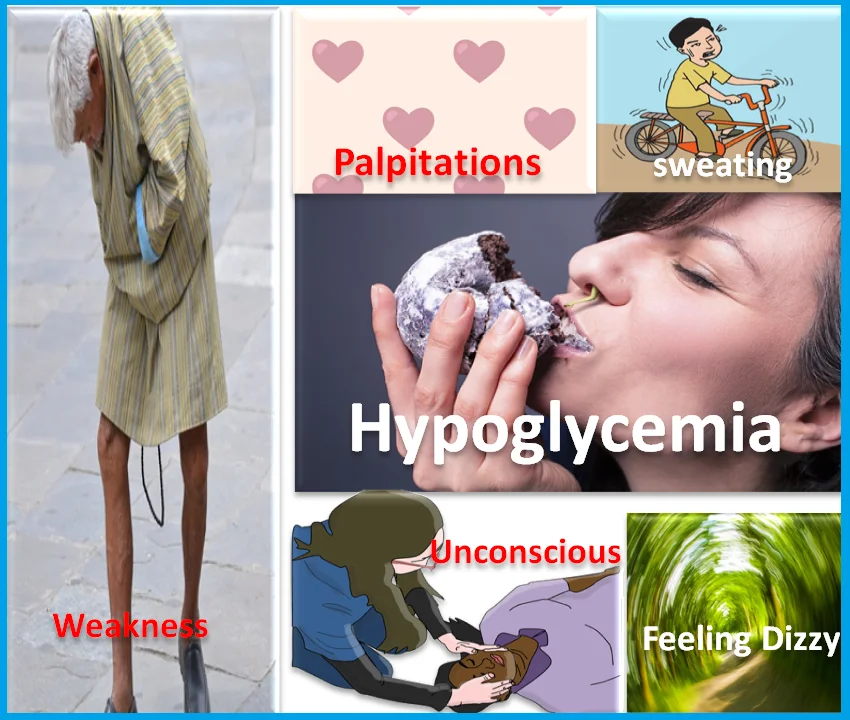 signs and symptoms of hypoglycemia