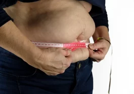Obesity and Hidradenitis Suppurativa in Children: A Growing Concern 6 types of obesity android