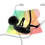 Gestational Hypertension: Complications, Diagnosis, & Treatment 32 hypertension in pregnancy gestational hypertension