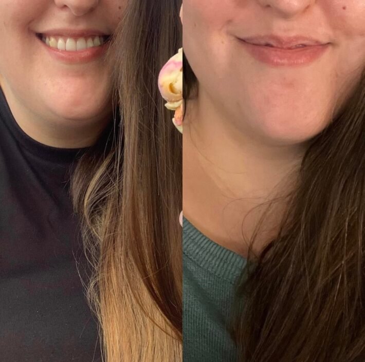 Ozempic Weight Loss Before and After Pictures & Reviews 18 22 lbs weight loss using Ozempic