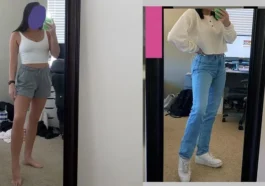 Before and after Ozempic Pictures:These are her new pictures after using Ozempic.