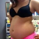 What does a PCOS belly look like What does a PCOS belly look like
