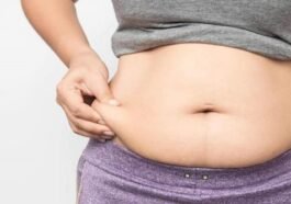 how to get rid of hanging belly after c section naturally without surgery