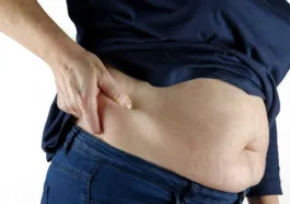 What does a PCOS belly look like