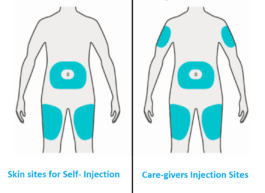 Why Does Dupixent Hurt So Much? How To Make Dupixent Hurt Less?