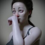 Symptoms of Ulcerative Colitis (UC) 20 Why does Dupixent Hurt So Much