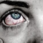 How to Get Rid of Red Eyes Fast 24 How To Get Rid of Red Eyes Fast diabetes and vision problems