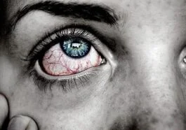 How To Get Rid of Red Eyes Fast diabetes and vision problems