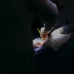 Bariatric Surgery Complications & How to Manage them 38 medical vs surgical weight loss complications of bariatric surgery weight loss surgery ozempic after gastric bypass adiponectin and weight loss after bariatric surgery