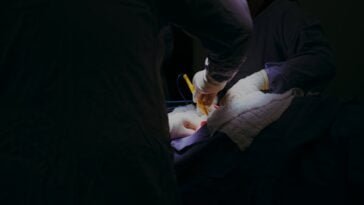 thyroid functions bariatric surgery complications gastric bypass complications, gastric sleeve complications years later, complications of bariatric surgery