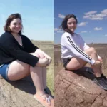 gastric sleeve 10 years later