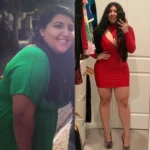 10 lbs weight dermoid cyst average weight gain with ovarian cyst