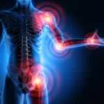Medications Used to Treat Rheumatoid Arthritis