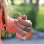 Does Mounjaro Cause Hair Loss? 28 biotin deficiency metformin hair loss mounjaro hair loss tirzepatide