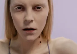 Ozempic face gaunted face