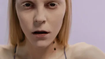 Ozempic face gaunted face