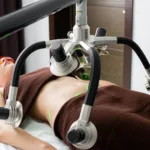 can you lose weight with coolsculpting