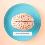 Plasma Exchange for MS