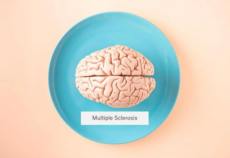 Plasma Exchange for MS