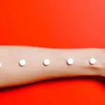 Cosentyx and Otezla Together for Psoriasis 29 Cosentyx and Otezla Together for Psoriasis