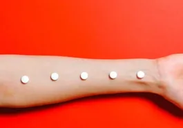 Cosentyx and Otezla Together for Psoriasis