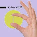 Kyleena and PCOS IUD