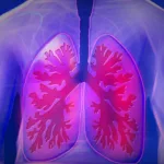 Esbriet vs Ofev (Pirfenidone Vs Nintedanib) lungs