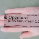 Incyte' Cream Opzelura for Vitiligo Opzelura Cream for Vitiligo Before and After Pics