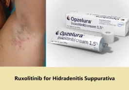 opzelura ruxolitinib for Hidradenitis suppurativa (stage II) in axilla