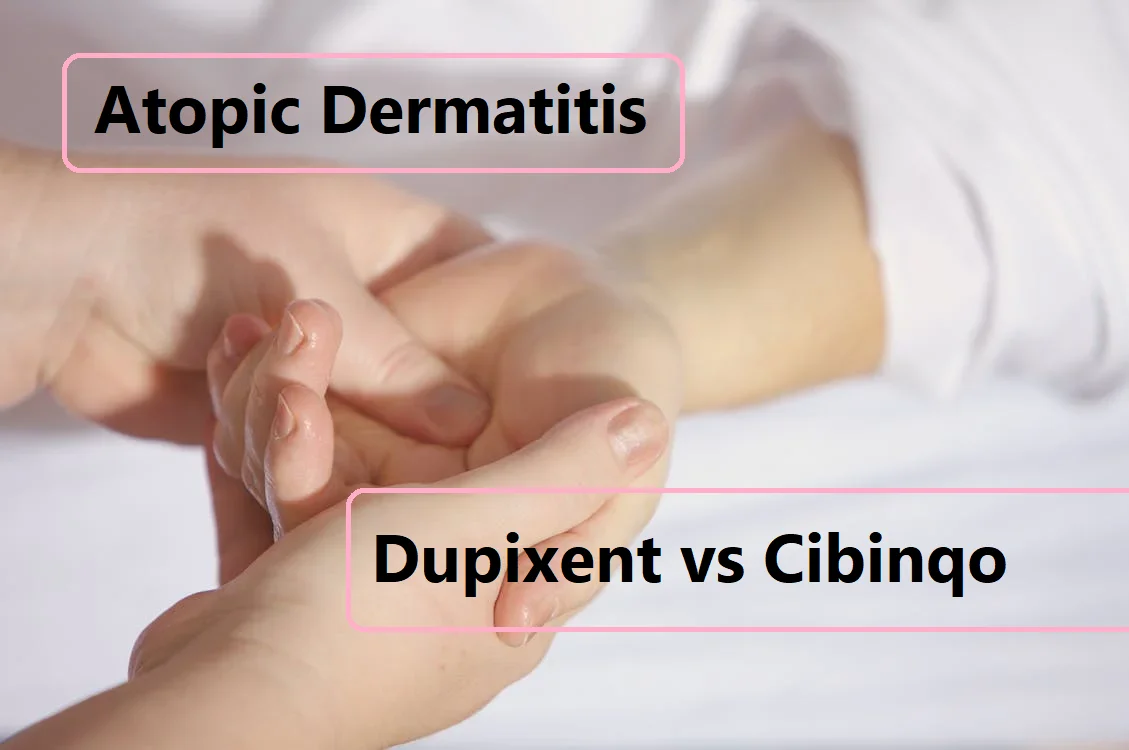 eczema treatment dupixent vs cibinqo (1)