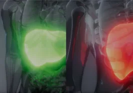 berberine for nafld and fatty liver disease nash