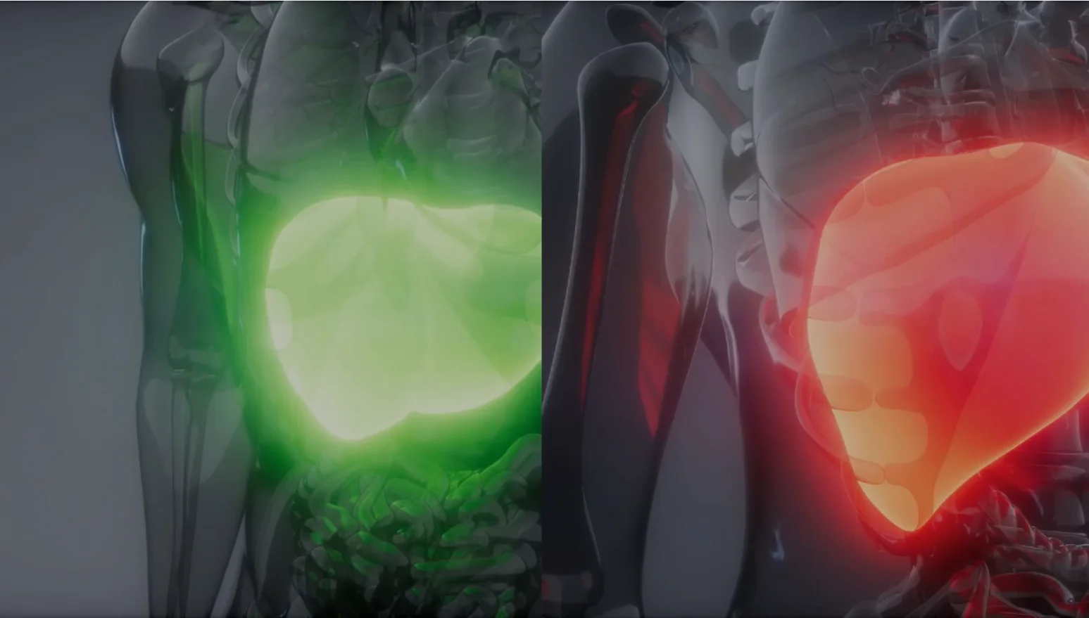 berberine for nafld and fatty liver disease nash