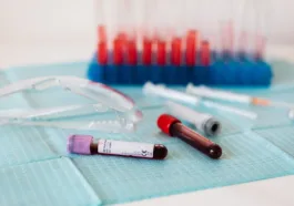 sample bottles lying on the counter in a laboratory