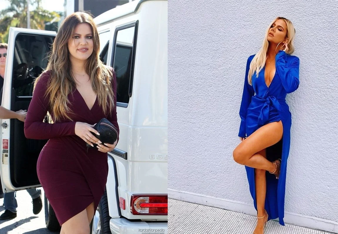 Celebrities Weight Loss Surgery and Their Outcomes 9 khloe kardashian weight loss before and after weight loss